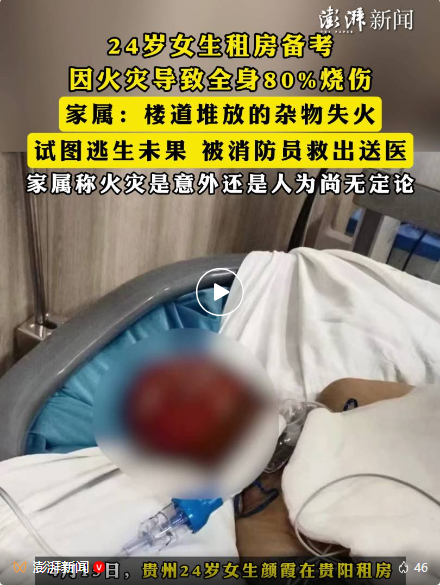 出租房楼道起火，24岁女生全身被烧伤！